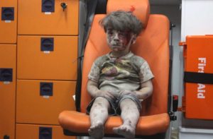 This image of five-year-old Omran Daqneesh has encapsulated the wretchedness of the Syrian war